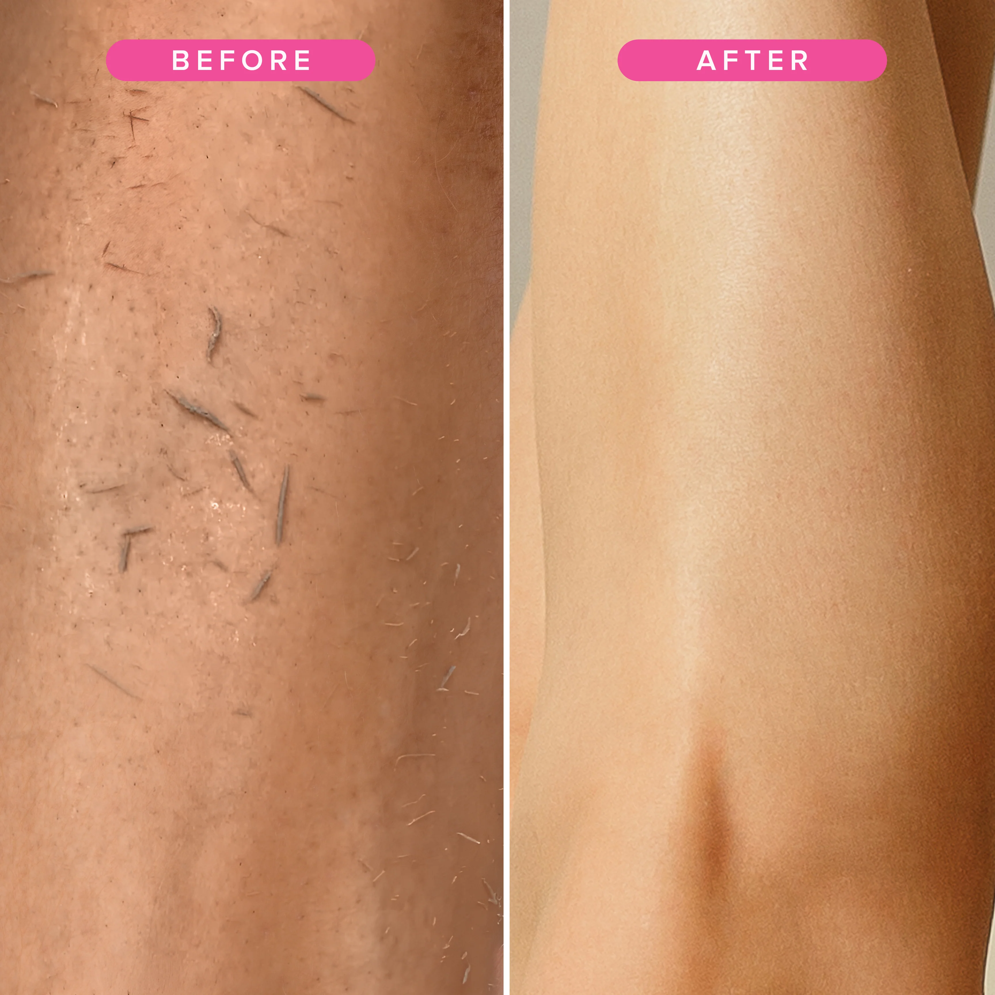Thumbnail 17